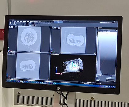 Man sieht einen Bildschirm auf welchem man die Scans eines CTs sieht. Dort sieht man einen Kürbis genauer gesagt das Innere davon. 